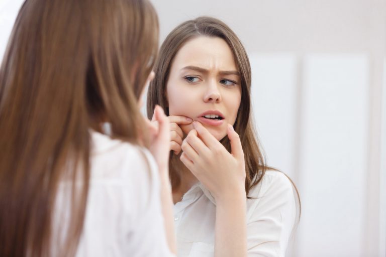 woman popping pimple